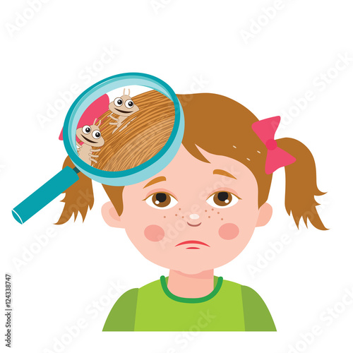 Girl With Lice. Magnifying Glass Close Up Of A Head. Vector Illustration: Dirty Head, Dirty Hair, Infection. Child With Lice. Mud Girl. Hygiene Promotion.