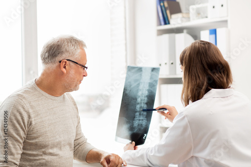Schilderij op canvas doctor with spine x-ray and senior man at hospital