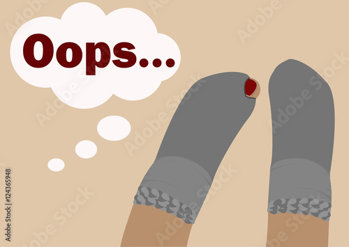 Holey socks. A pair of socks with holes which show thumb. Illustration in a flat style.Text ...Oops.