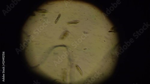 Paramecium Caudatum photo