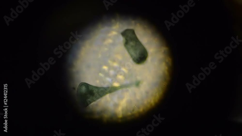 Stentor Polymorphus photo
