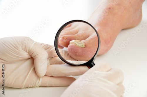 podologist checking the patient foot