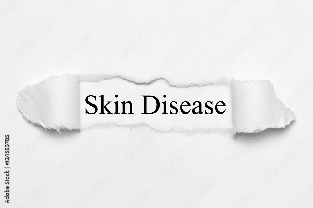Obraz premium Skin Disease on white torn paper