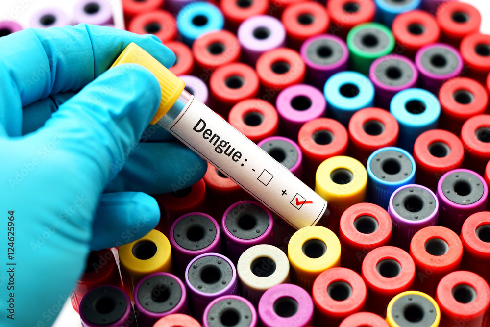 Fototapeta premium Blood sample positive with dengue virus