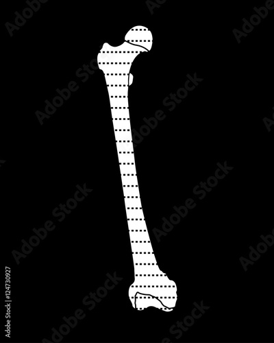 femur bone
