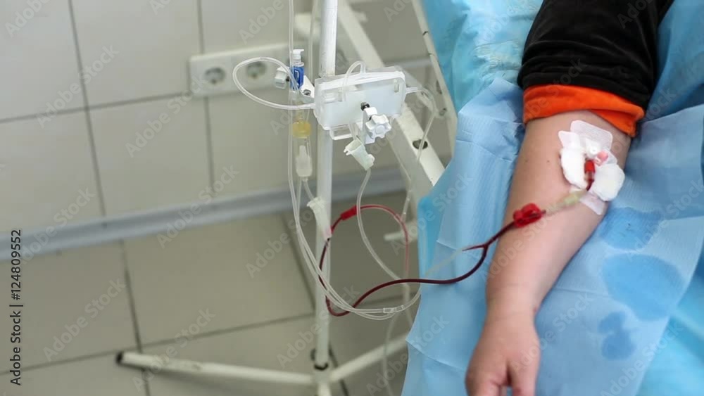 Patient passes plasmapheresis procedure in clinic
