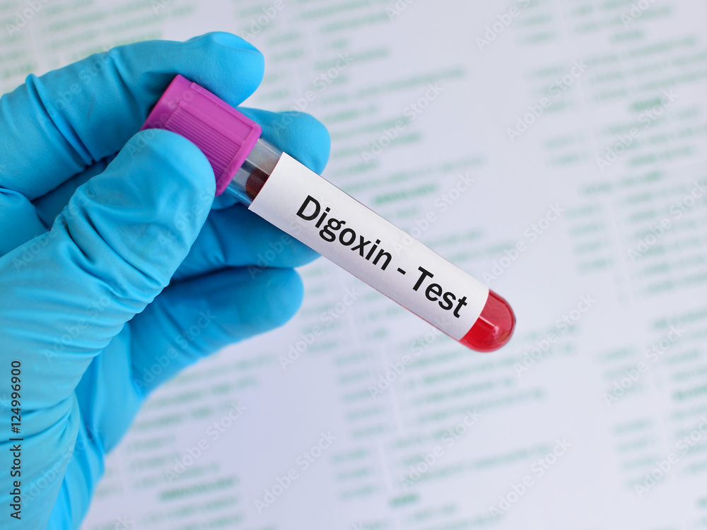 Obraz premium Blood sample for digoxin (drug for heart disease) level test 