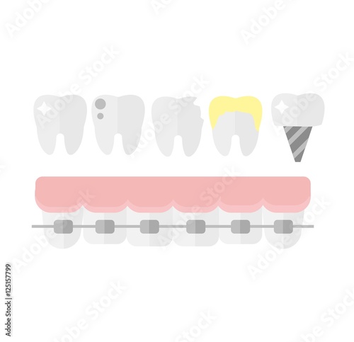 Teeth dental mouth with care braces vector.