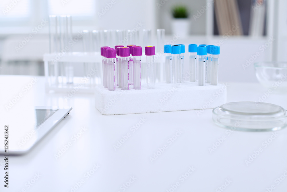 Research laboratory working space. Test tubes and tablet PC are lying at the table. Medical equipment. Blood test Research laboratory working space. Test tubes and tablet PC are lying at the table. Medical equipment. Blood test