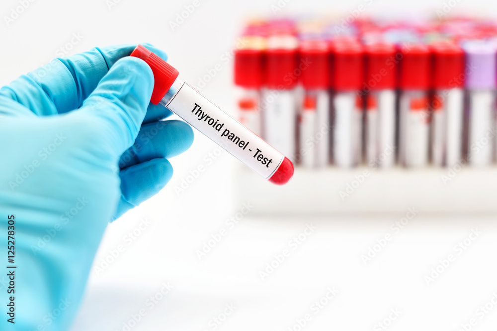 Obraz premium Blood for thyroid panel test