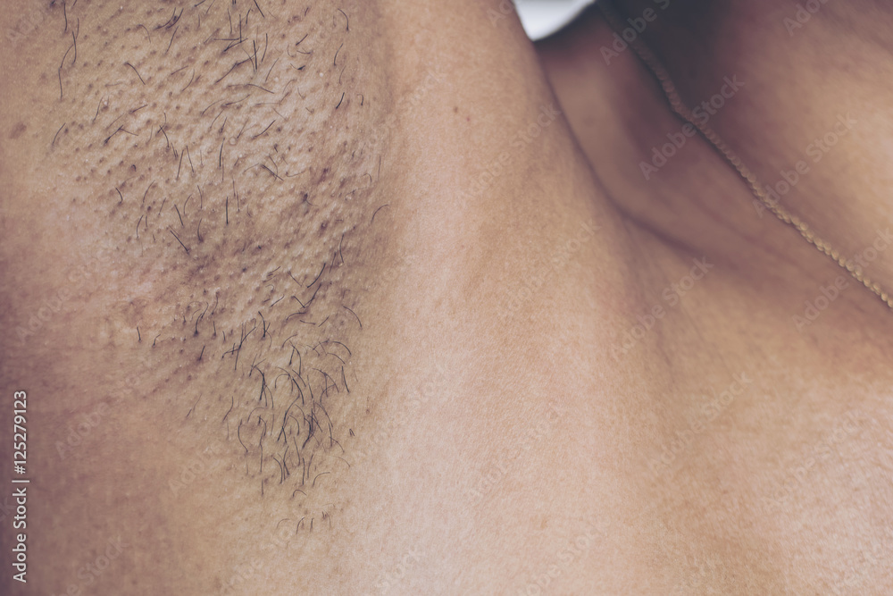 Women have lot of Hairy armpits black and long. Stock Photo | Adobe Stock