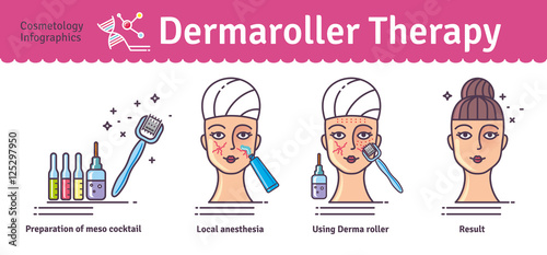 Vector Illustrated set with cosmetology Derma Roller therapy