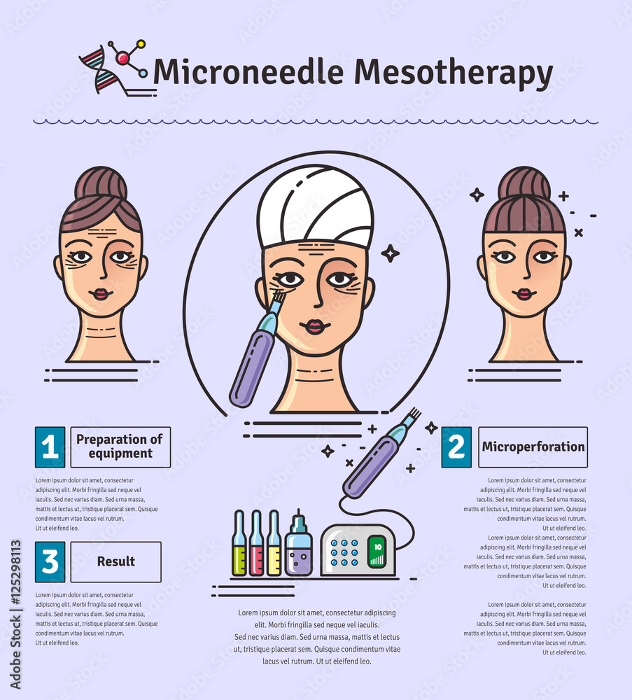 Vector Illustrated set with salon Micro needle mesotherapy Stock Vector ...
