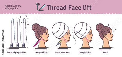 Vector Illustrated set with face lifting surgery by threads