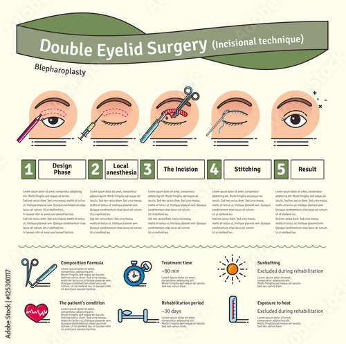 Vector Illustrated set with double eyelid surgery