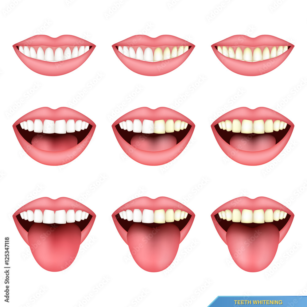 Obraz premium set of mouth and teeth, tooth whitening..