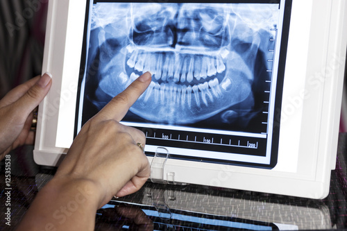 Dental Panoramic X-ray