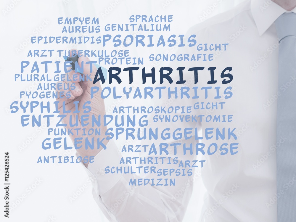 Arthritis