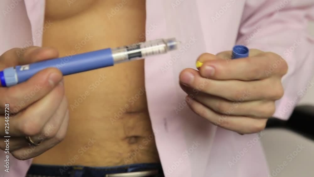 Injections of insulin to blood sugar disease. Diabetic Glycemic control. Dependent first type