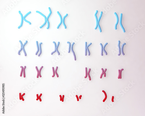 Philadelphia chromosome karyotype male or female. 3D illustration showing defective 9 and 22 chromosomes with translocational defect which causes cause chronic myelogenous leukaemia