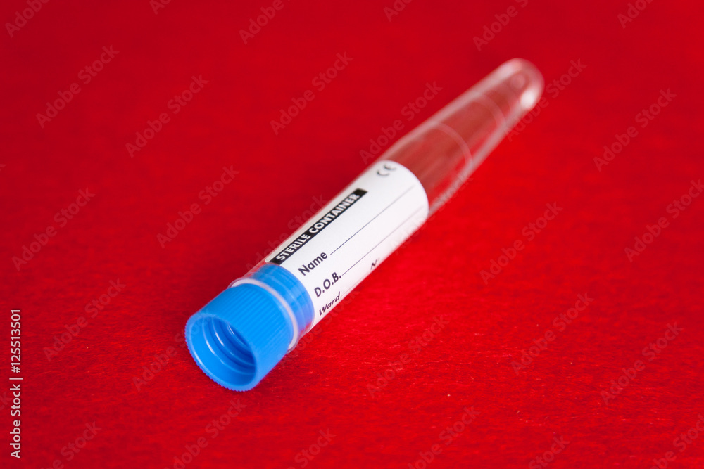 Provetta. Analisi cliniche Provetta. Analisi cliniche