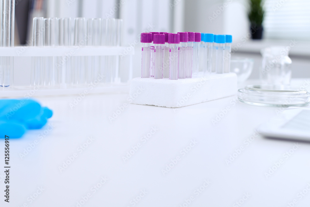 Research laboratory working space. Test tubes and tablet PC are lying at the table. Medical equipment. Blood test Research laboratory working space. Test tubes and tablet PC are lying at the table. Medical equipment. Blood test