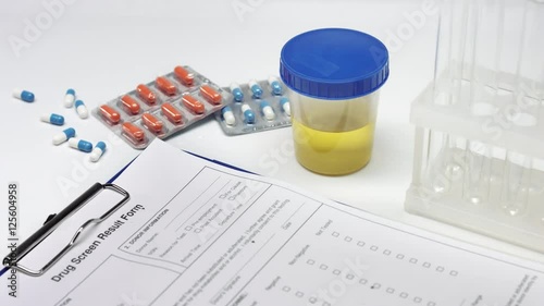 Hand in blue gloves put urine sample on table with pills and drug test result on it