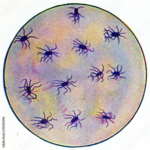 Φωτογραφία Germs of typhoid fever, vintage engraving.