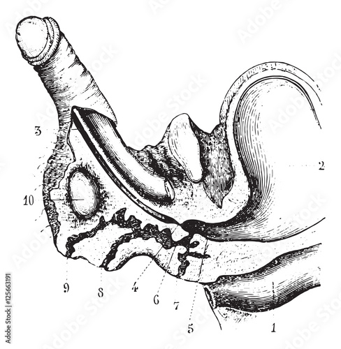 Fényképezés Urinaries urethral fistula caused by a cooling, vintage engravin