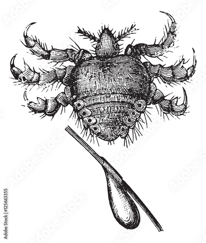 Pubic louse or crab louse, vintage engraving.