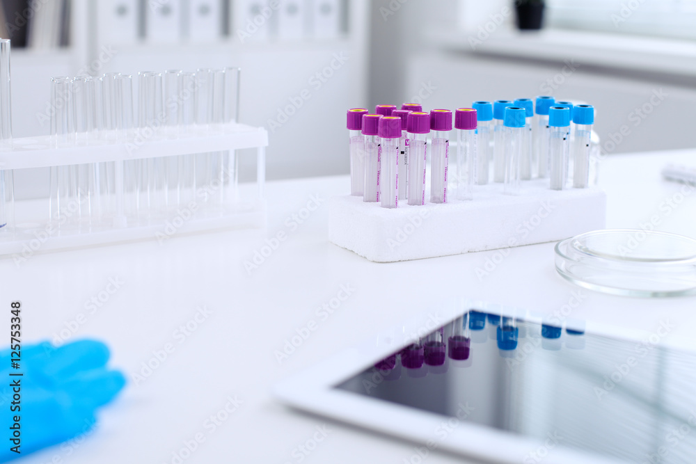 Research laboratory working space. Test tubes and tablet PC are lying at the table. Medical equipment. Blood test