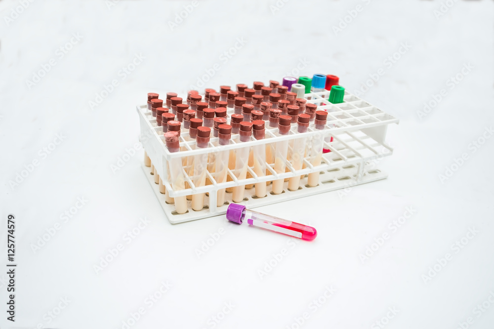 lab equipments : Bottle vaccine, Blood tube,needle,Syring, urine box, sputum box. lab equipments : Bottle vaccine, Blood tube,needle,Syring, urine box, sputum box.