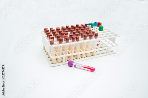 lab equipments   Bottle vaccine  Blood tube needle Syring  urine box  sputum box.