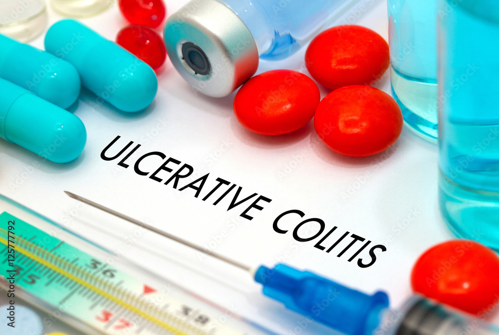Fotografija Ulcerative colitis