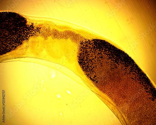 Human whipworm (Trichuris trichiura) female - permanent slide plate under high magnification photo