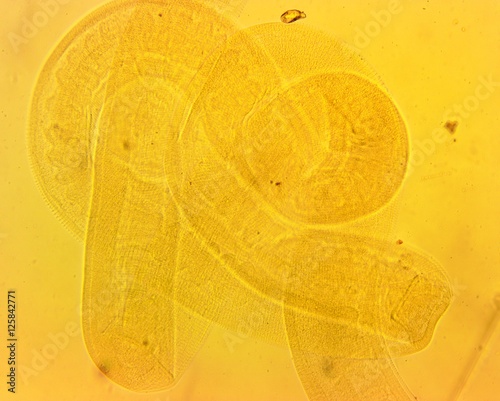 Human whipworm (Trichuris trichiura) female - permanent slide plate under high magnification photo