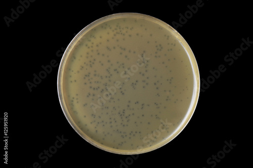 Bacteriophage plaques (clear zone) within the lawn bacterial aga