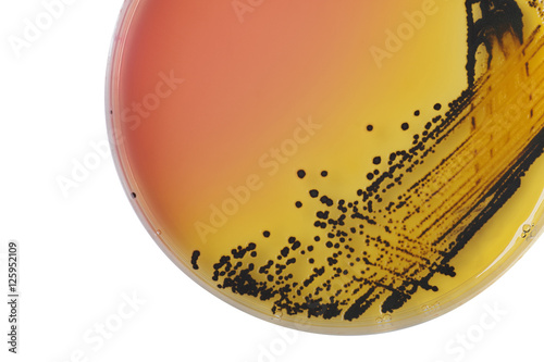 Black bacterial colonies of Salmonella species on Salmonella Shi photo