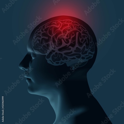 Healthcare and migraine concept - vector illustration