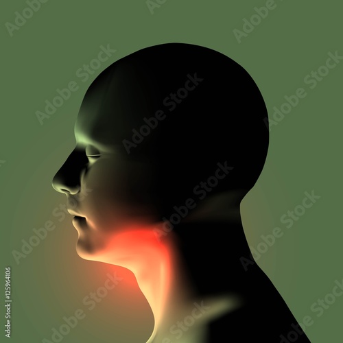 Laryngitis vector illustration. Human throat irritation.