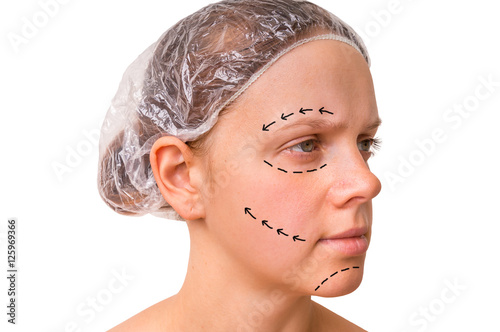 Doctor makes dotted lines on female face for cosmetic face lift