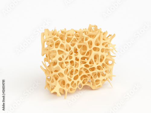 Bone structure part with osteoporosis isolated on white photo