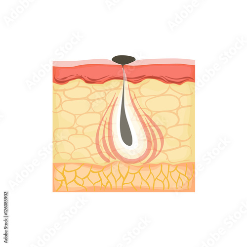 Dermatology Skincare Anatomical Info Illustration Demonstrating Acne Skin Problem Development