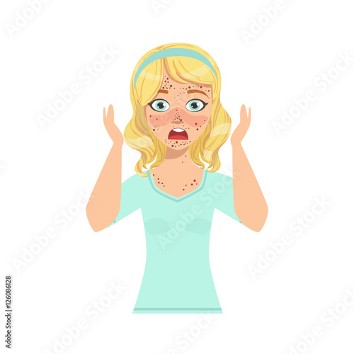 Girl Shocked With Her Horrible Problematic Skin In The Morning And Horrified By The Red Rush
