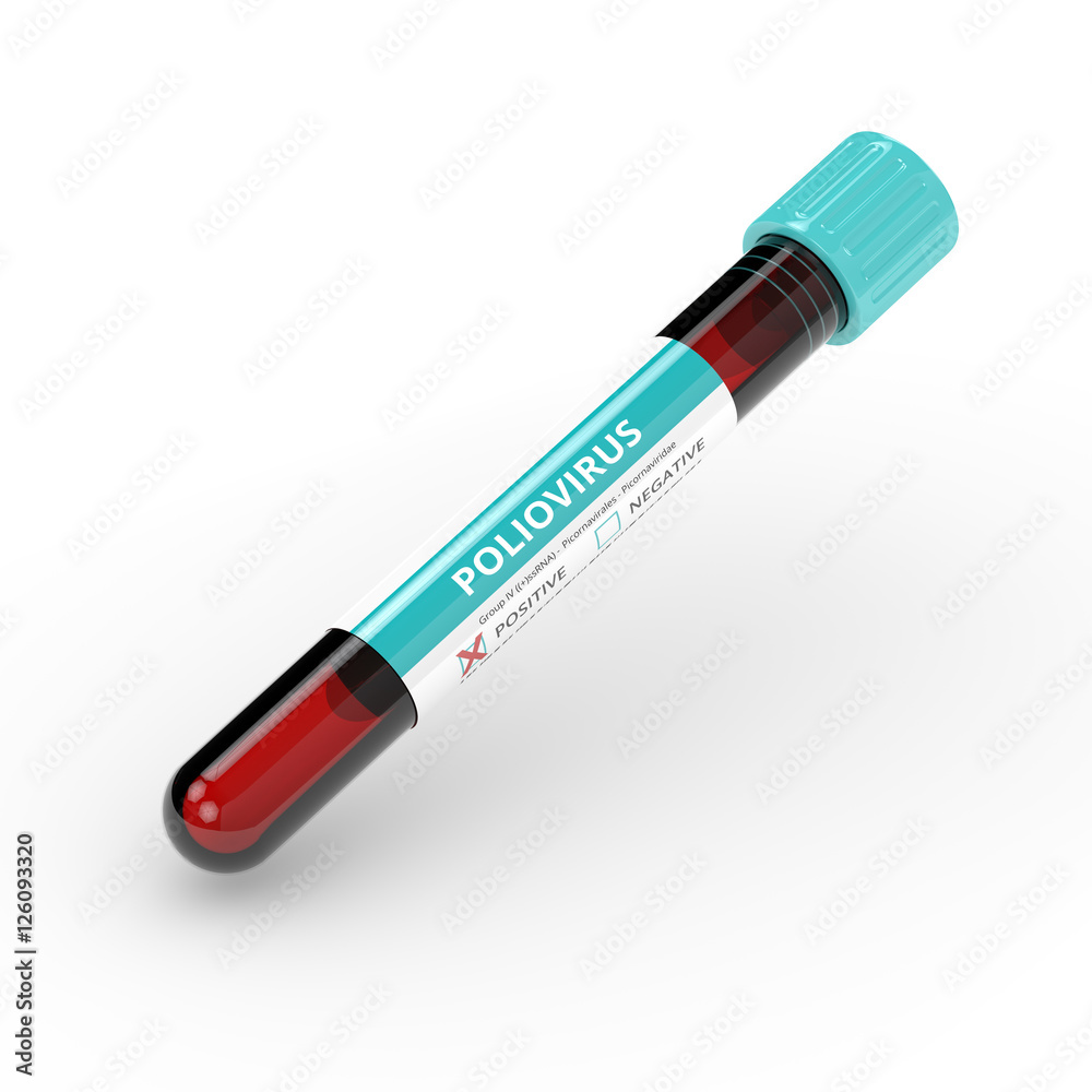 3D rendering of poliovirus test tube blood sample 3D rendering of poliovirus test tube blood sample