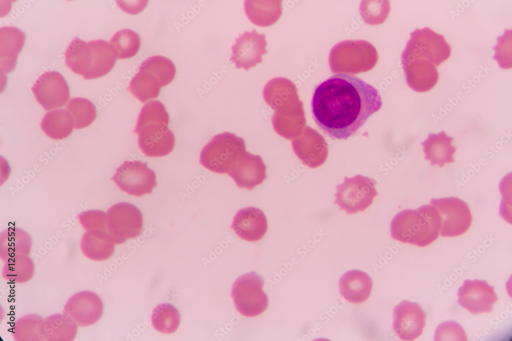 slide blood smear show plasma cell for complete blood count