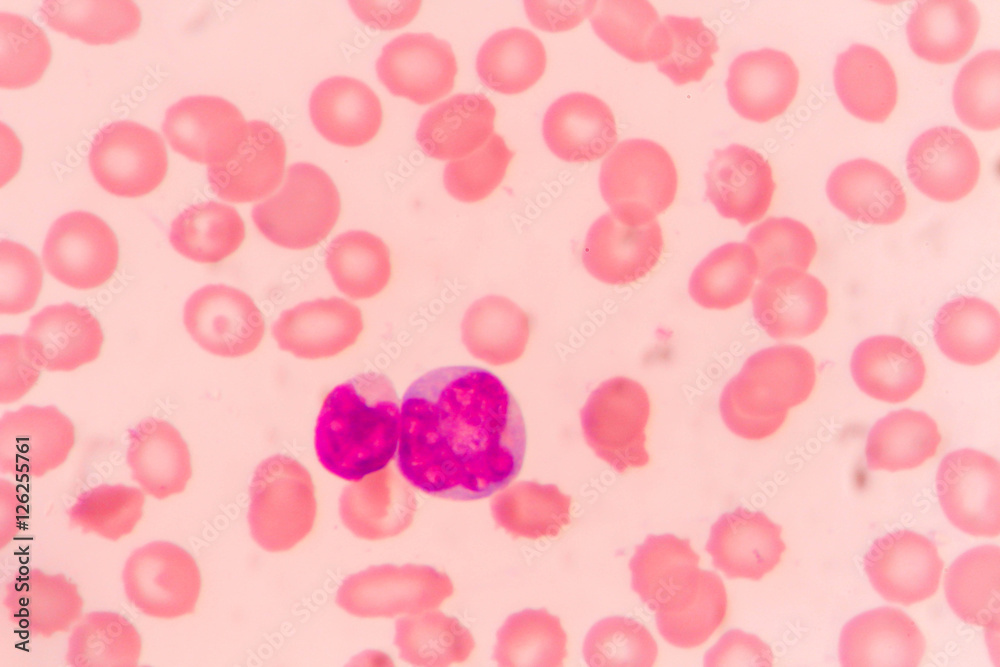 slide blood smear show monocyte for complete blood count
