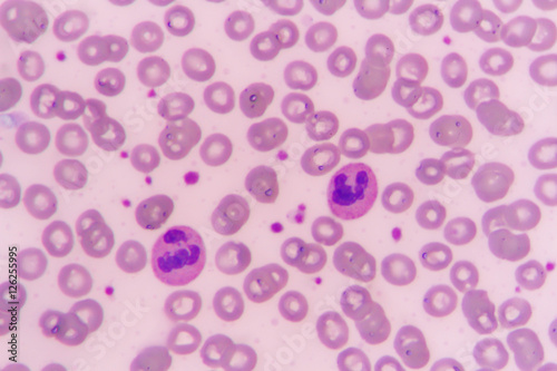 slide blood smear show neutrophil for complete blood count