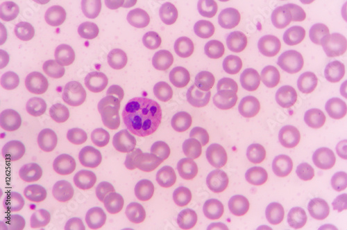 slide blood smear show neutrophil for complete blood count