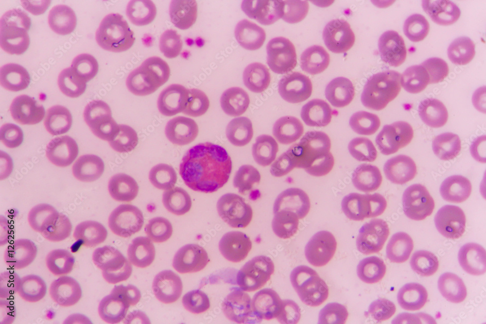 slide blood smear show Eosinophil for complete blood count